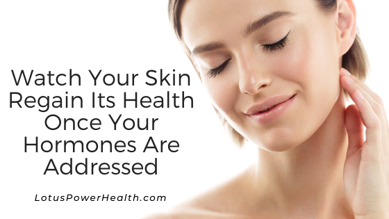 Watch Your Skin Regain Its Health Once Your Hormones Are Addressed